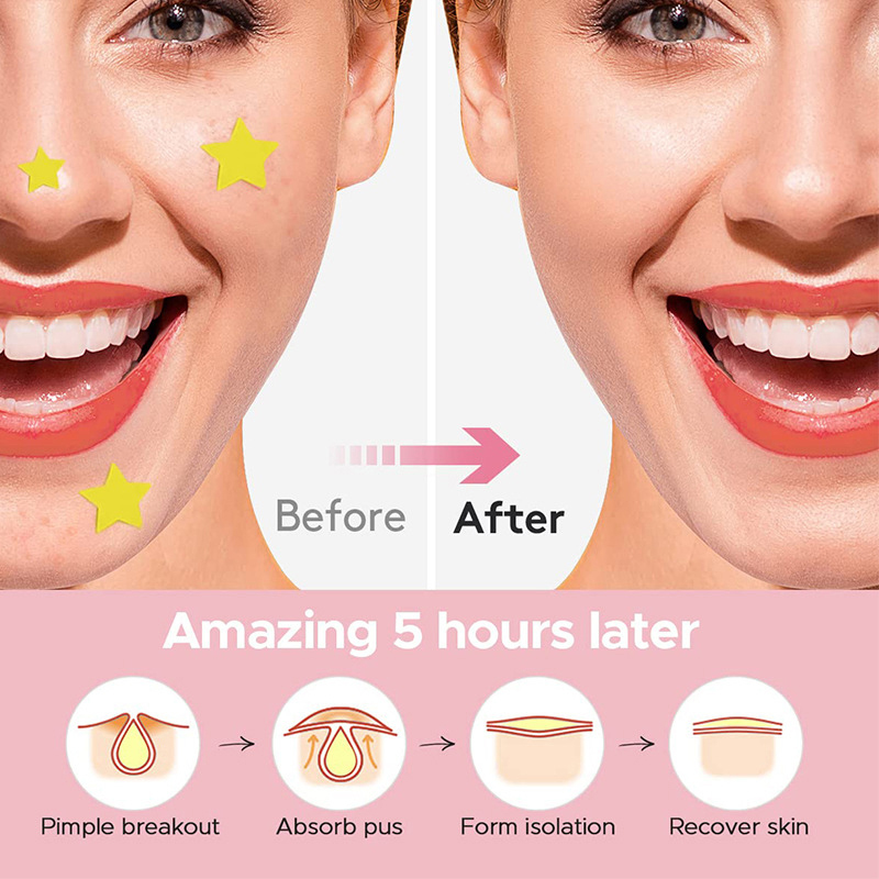 แผ่นแปะสิวรูปดาว 600 ชิ้น/ชุด  - Beauty For Makeup บทวิจารณ์และราคา
